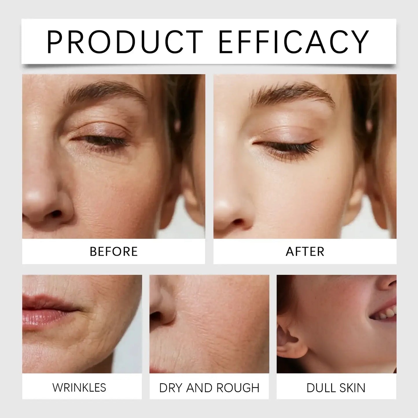 Oligopeptide Micro-Needle Repair Serum – additional view 3